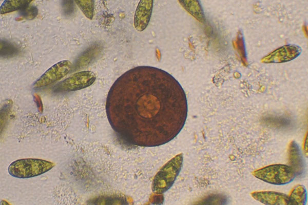 Uhrglastierchen im Wassertropfen